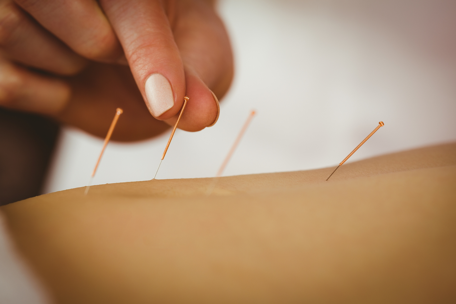 Acupuncture :Understanding What the Needle Poke Can Evoke Acupuncture :Understanding What the Needle Poke Can Evoke